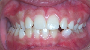 dental midlines