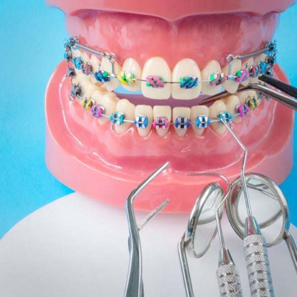 Background of Adult Orthodontics image