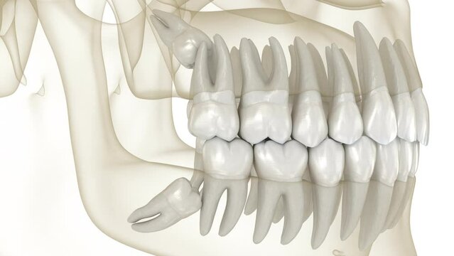 Dental Crowding Orthodontics Sterling