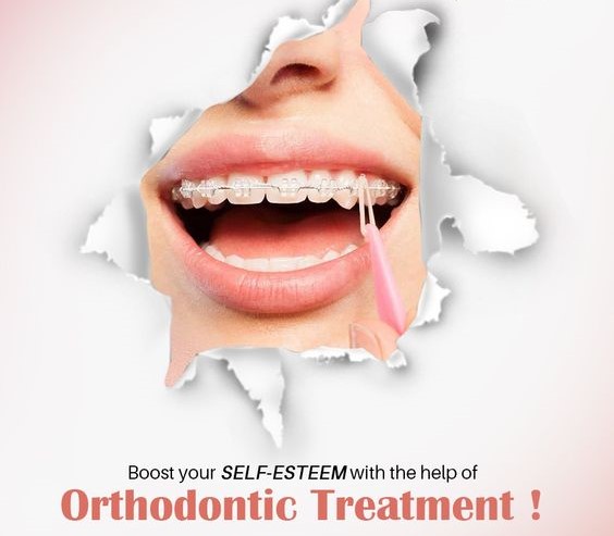 How Orthodontic Treatments Helps Image