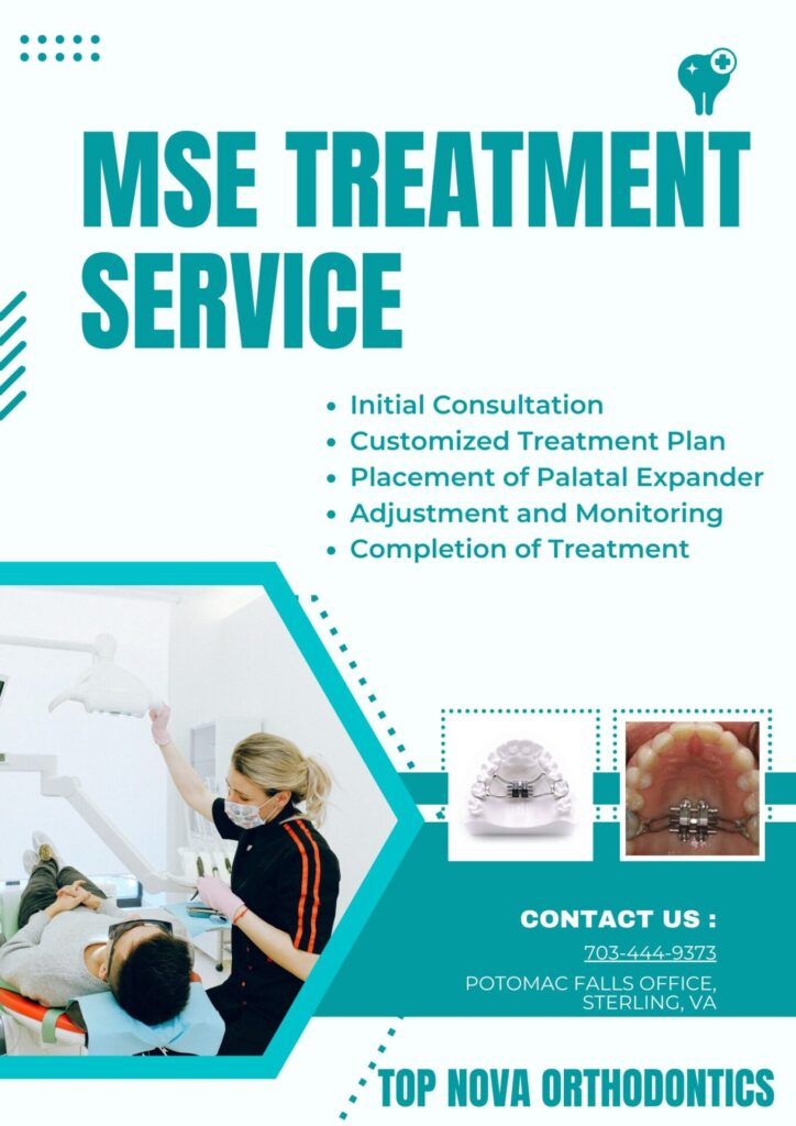 process of MSE treatment Image