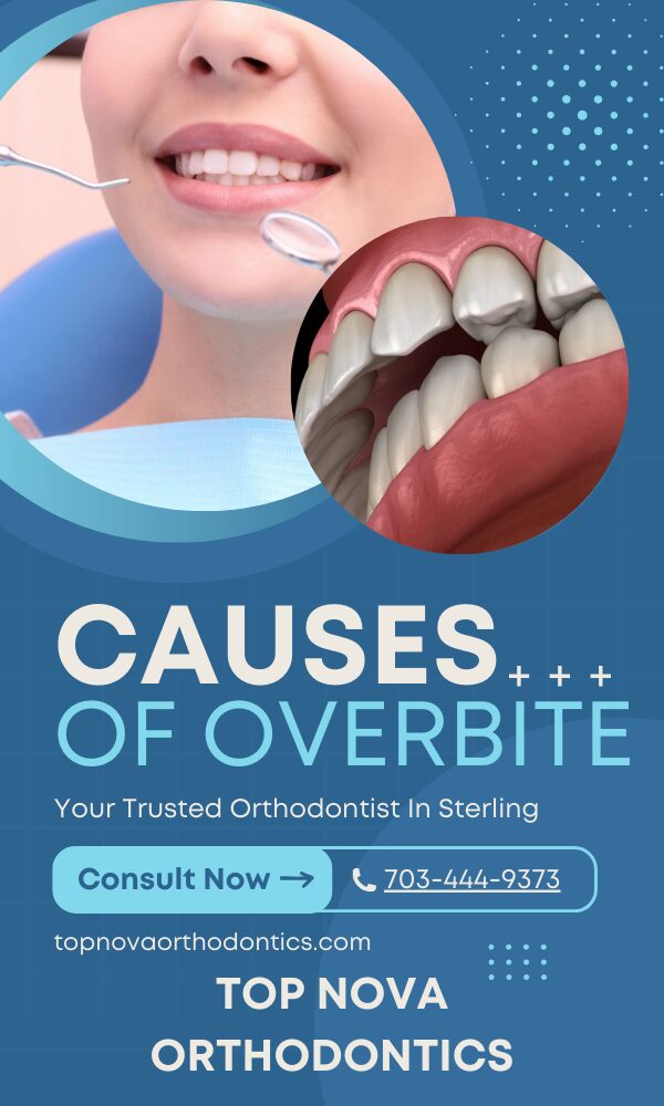 What Causes an Overbite Image