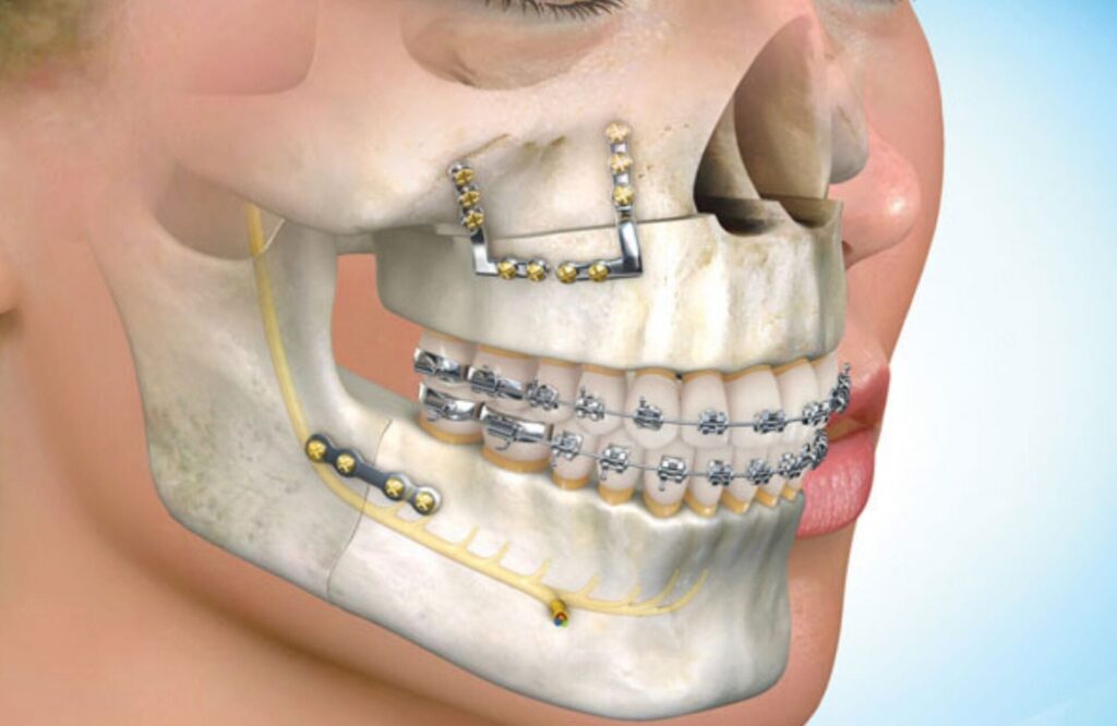 Specialized Orthodontics Services Image