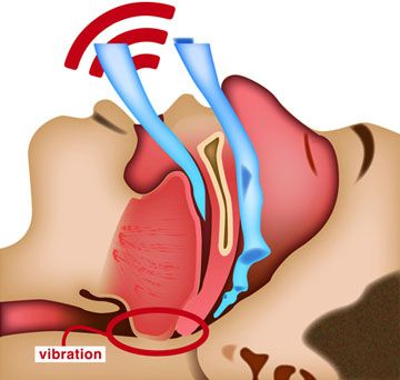 Why Airway Treatment Image