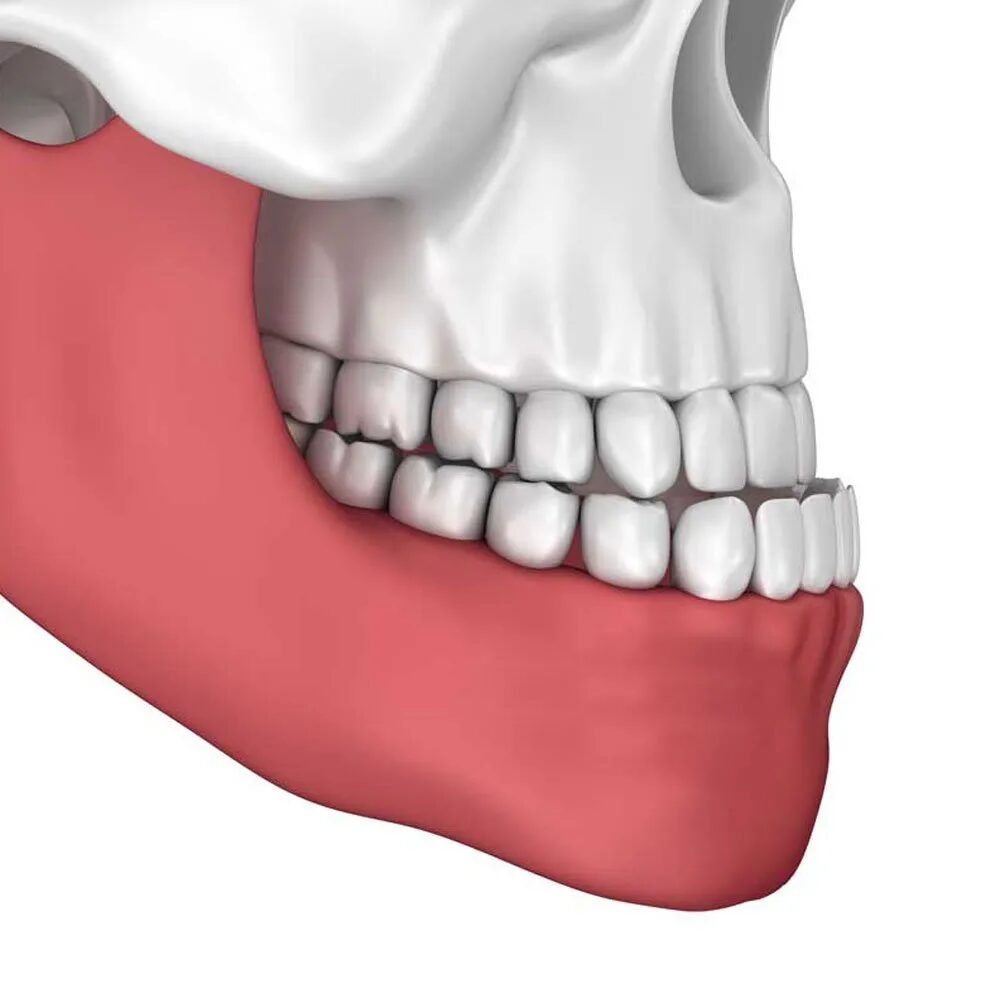 Treating An Underbite Issues Image