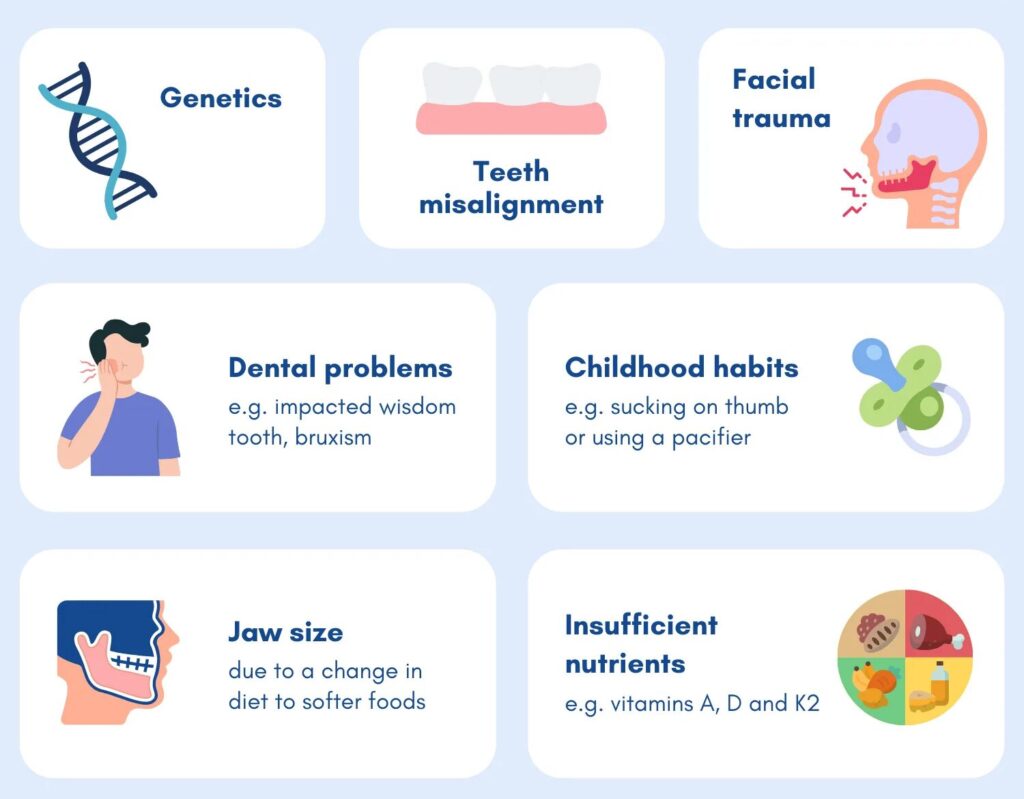 Causes of Misalignment Of Teeth